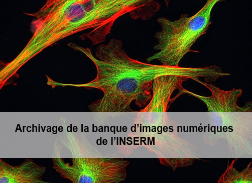 Cellules fibroblastiques étalées sur un support en verre traité par un revêtement de multicouches de polyélectrolytes. Image réalisée à l'U1121 "Biomatériaux et Bioingénierie", Strasbourg.