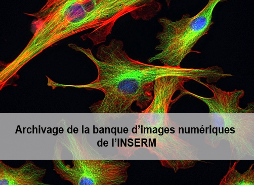 Cellules fibroblastiques étalées sur un support en verre traité par un revêtement de multicouches de polyélectrolytes. Image réalisée à l'U1121 